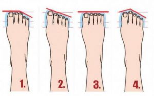 Пръстите на краката определят вашия характер